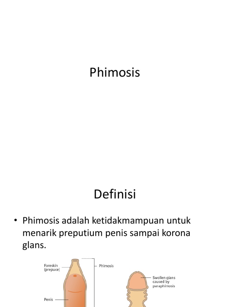 Phimosis Ppt