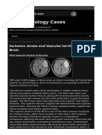 Ischemic Stroke and Vascular - HTML PDF