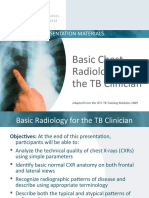 TB Radiology Basic Presentation Slides