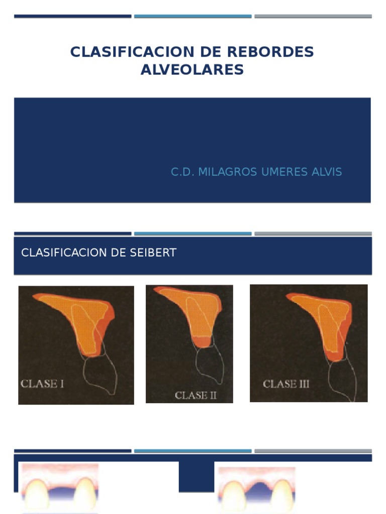 Clasificacion de Rebordes Alveolares | PDF