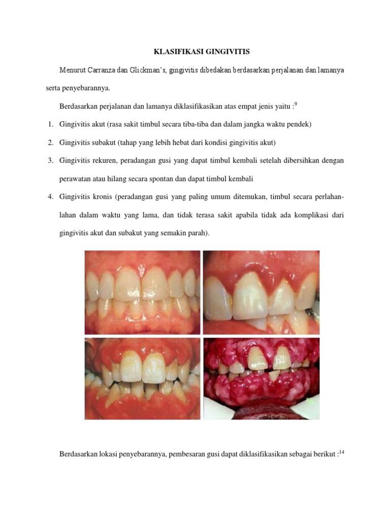 Klasifikasi Gingivitis PDF