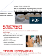 Incrustaciones Cariologia