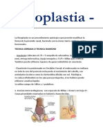 Rinoplastia