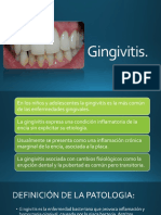 Gingivitis