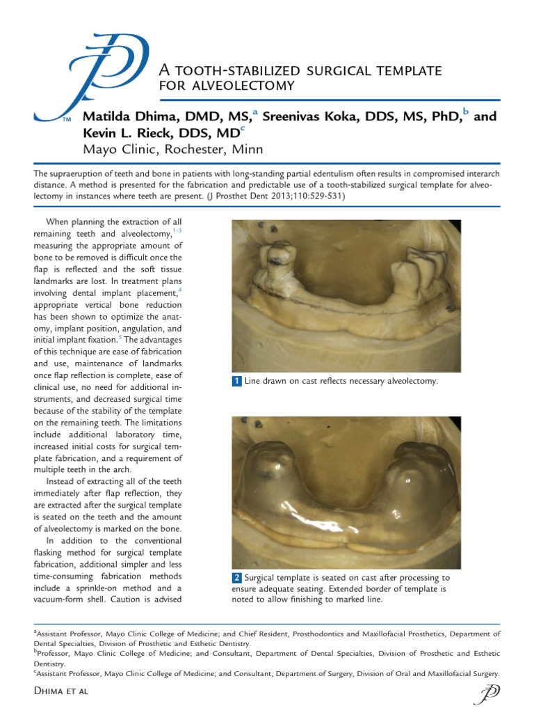A ToothStabilized Surgical Template For Alveolectomy PDF Dental