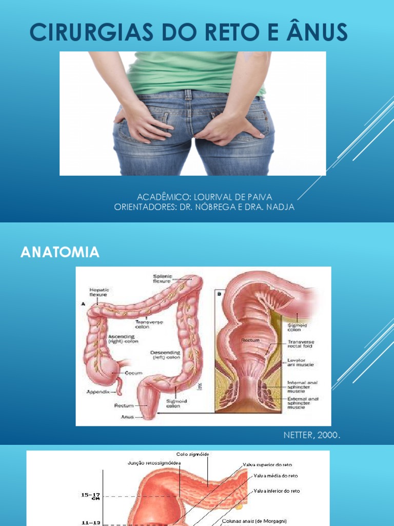 Cirurgias do Reto e Ânus: Anatomia e Tratamentos | PDF | Hemorroida ...