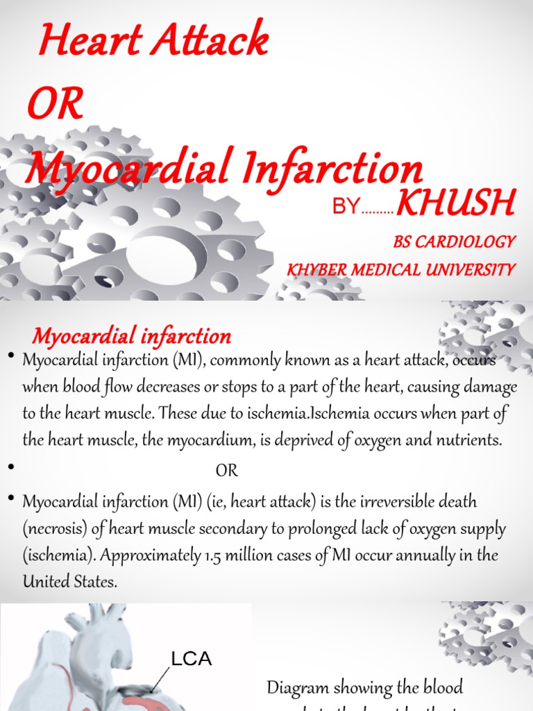 Understanding Myocardial Infarction | PDF | Myocardial Infarction ...