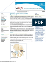 Reemplazo Total de Cadera (Total Hip Replacement)-OrthoInfo - AAOS