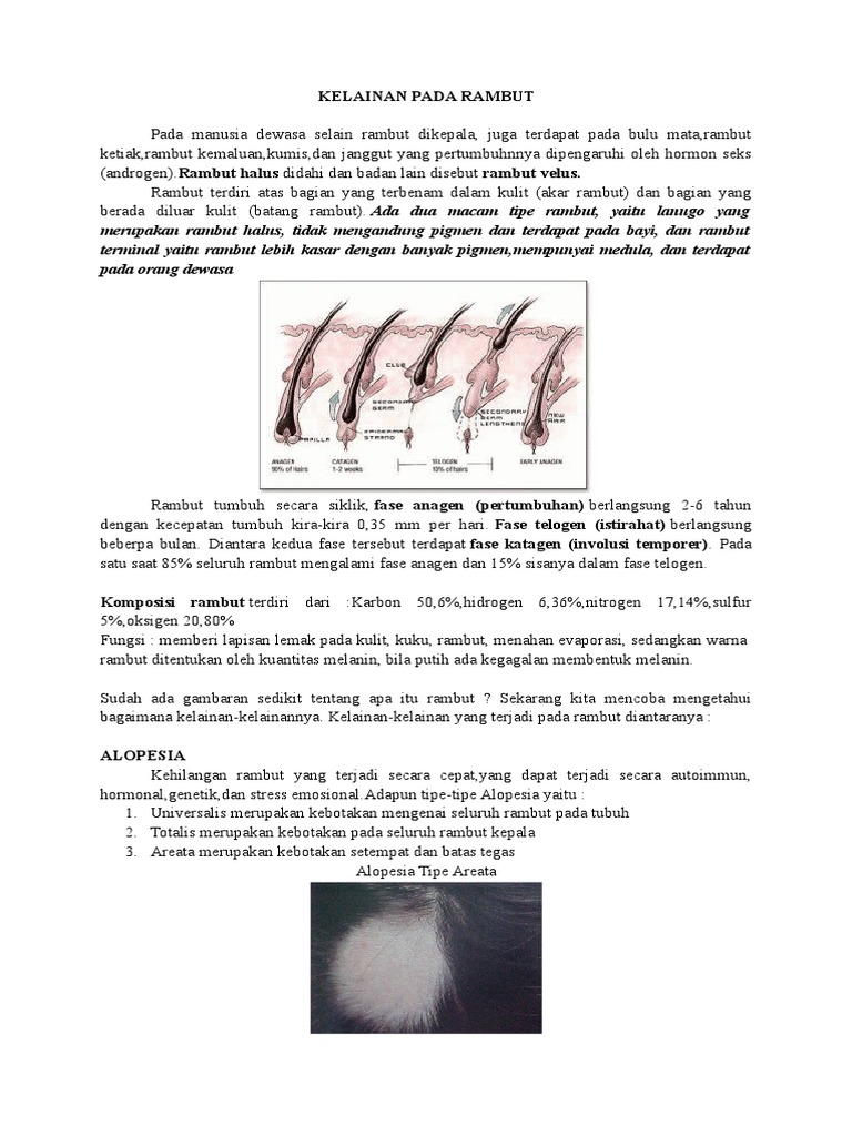 Kelainan Pada Rambut | PDF