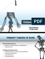 Osteosarcoma Kipyatullizam