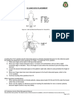 12 Lead Ecg Placement: ACT Ambulance Service Clinical Management Manual