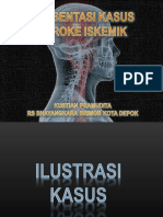 Casekus Stroke Iskemik