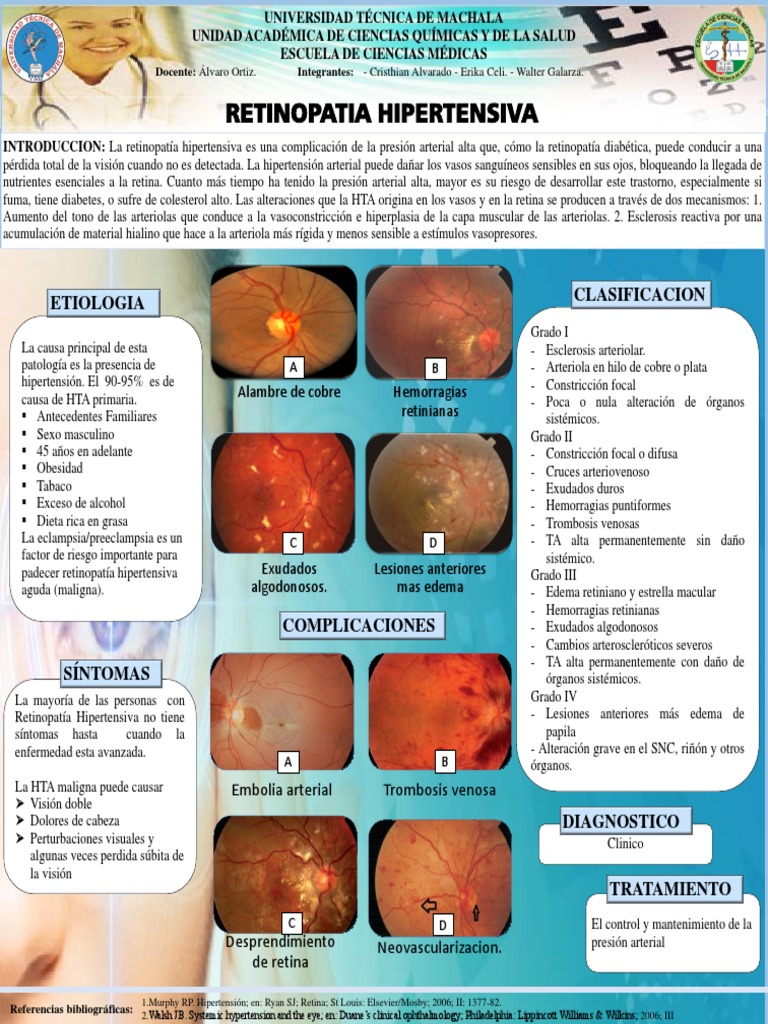 Retinopatia Hipertensiva PDF Enfermedades y trastornos Medicina