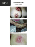 Download Autohemotherapy - Treatment of Scleroderma by Olivar SN35522455 doc pdf