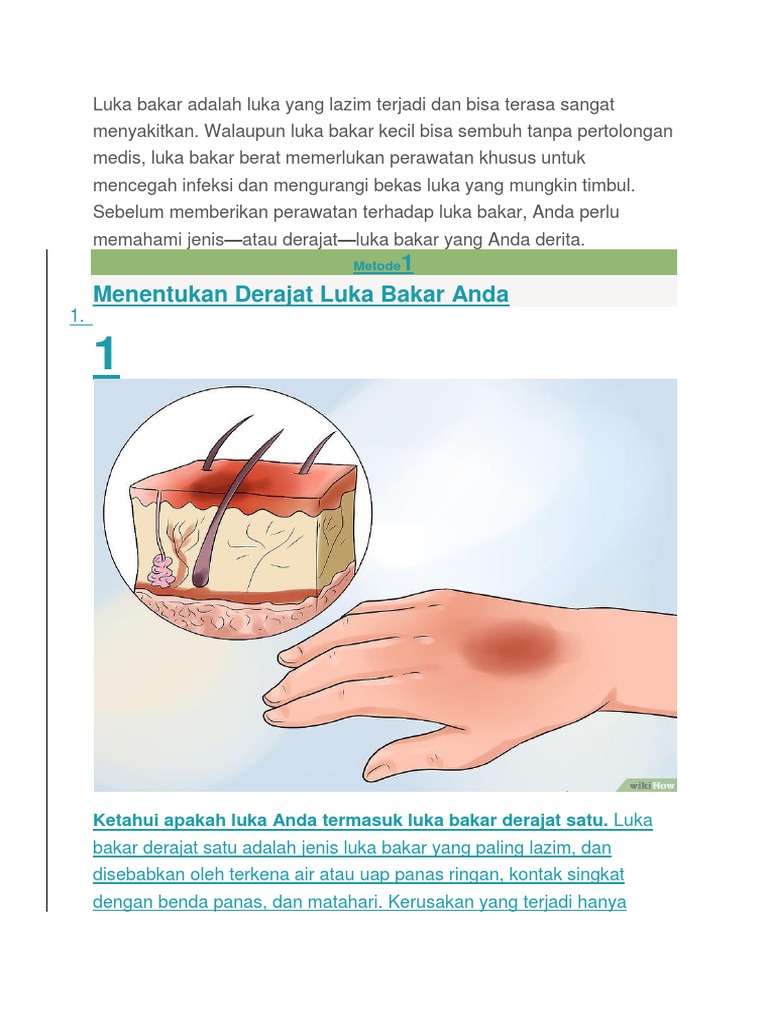 Perawatan Luka Bakar | PDF