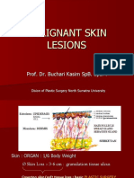 Malignant Skin Lesions
