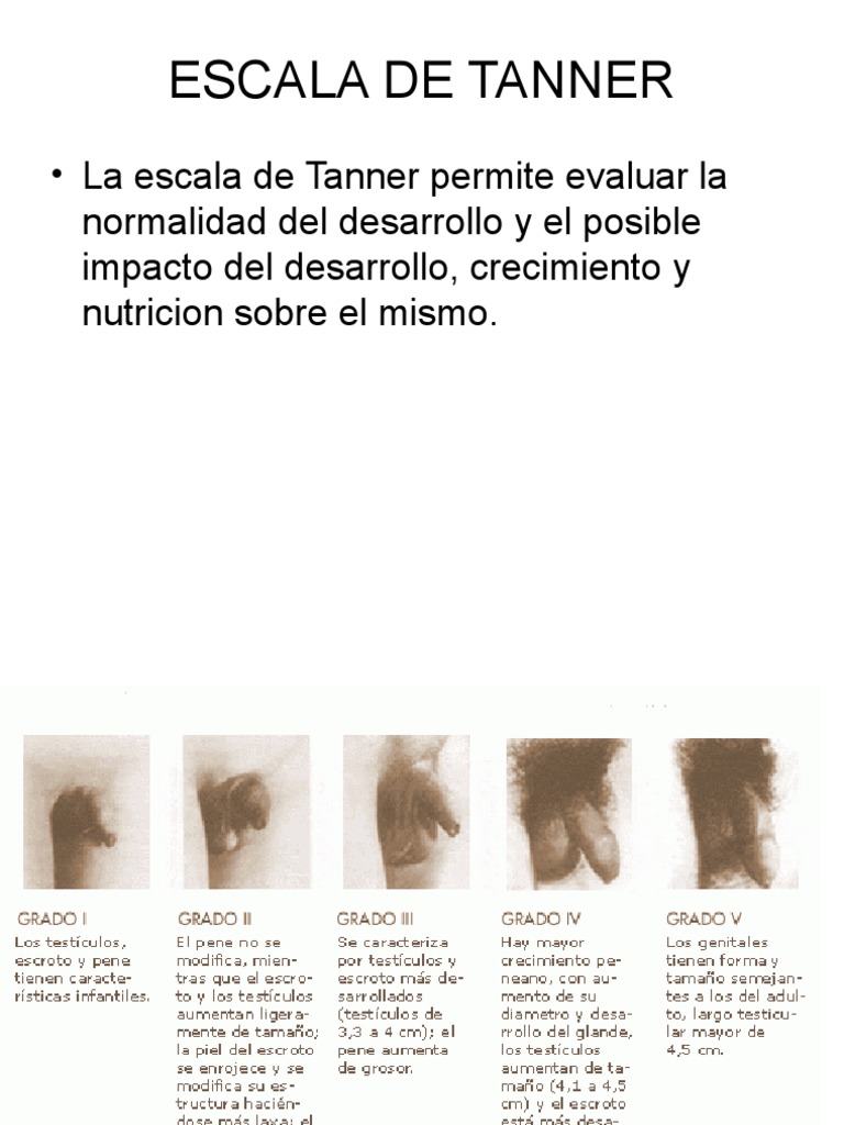 Escala de tanner 22 pdf