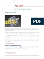 Rehabilitación Implantosoportada Con El Uso de Cerec Guide®reporte de Un Caso