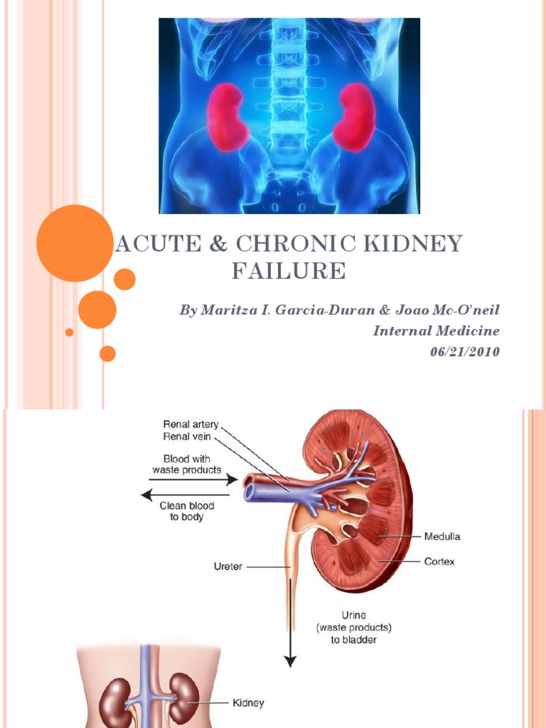 powerpoint presentation of renal failure