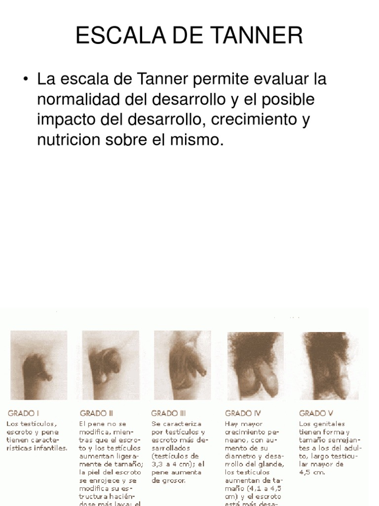 Escala De Tanner Ninos Y Ninas