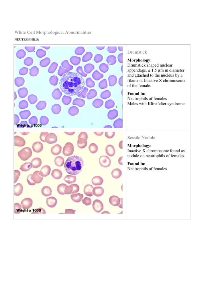 Is It Granular A Simple Guide To Blood Cell Classification - qsdnadl