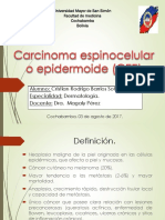 Carcinoma Espinocelular o Epidermoide (CEE)