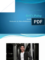 Bells Palsy Deya