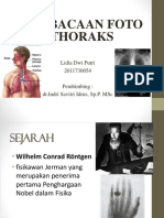 Rontgen Thoraks Refreshing Dr. Indri