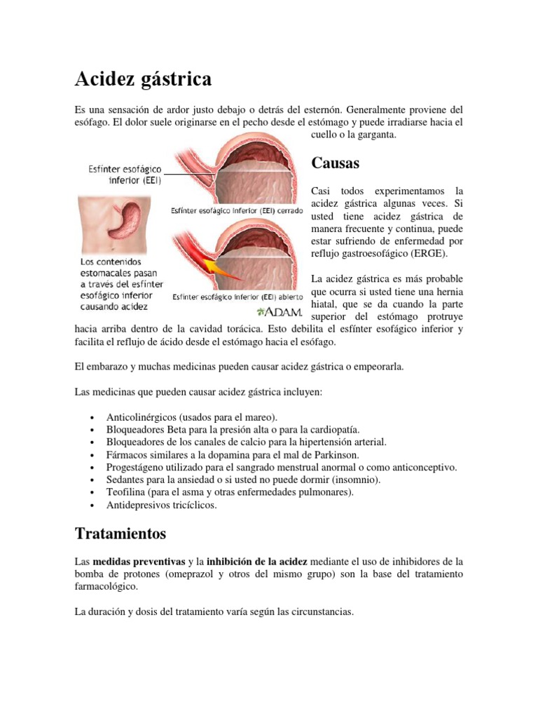 Causas y Tratamientos de Acidez Gástrica | PDF | La enfermedad por ...