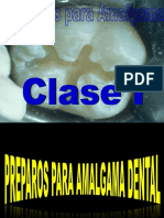  Amalgamas Dentales Clase I