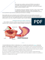 Tratamento Caseiro para H Pylori