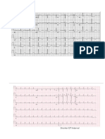 EKG 12 LEAD