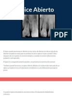 endodoncia apice abierto.pptx