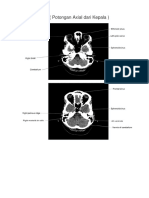 Axial Head Anatomi Radiologi