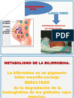 Eritroblastosis Fetal