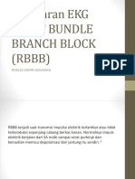 Gambaran Right Bundle Branch Block (RBBB) Presentasi