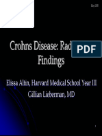 Crohns Disease: Radiologic Findings