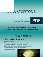 Gambaran Klinis Dermatofitosis (Prof. Bambang Sp. KK)