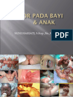 Tumor Pada Bayi Dan Anak