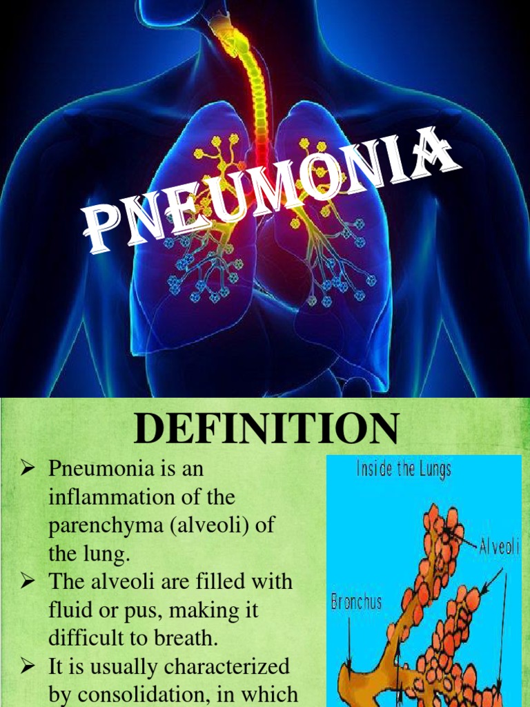 Austin Journal of Lung Cancer Research Pneumonia
