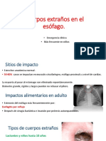 Cuerpos Extraños en El Esófago