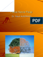 Facial Nerve Palsy: Dr. Saud Alromaih