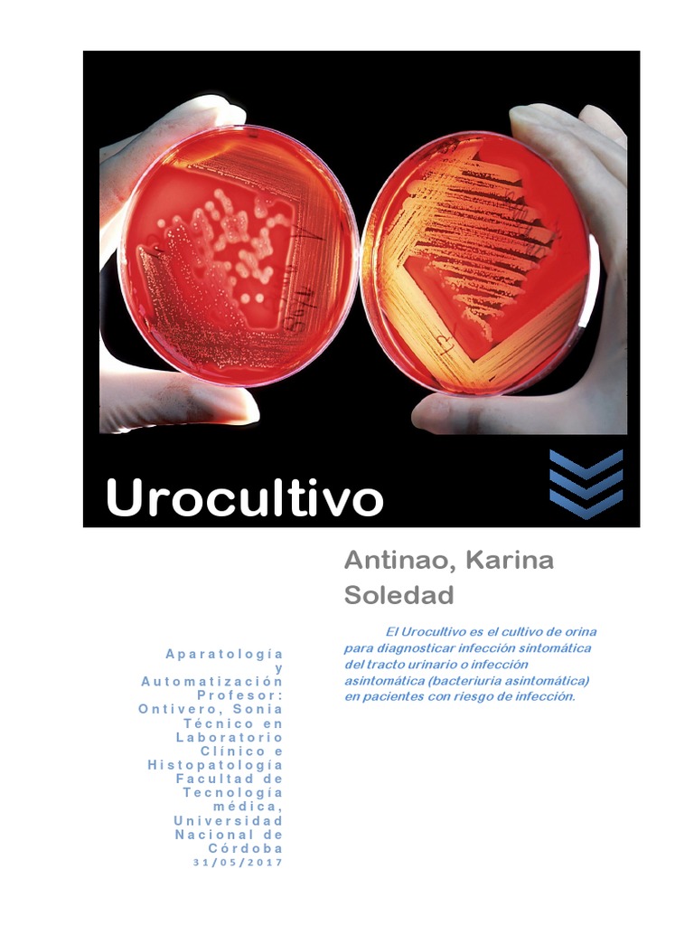 Urocultivo Orina Microbiología