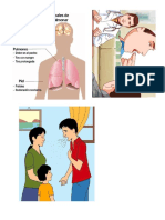 Tuberculosis Imagenes