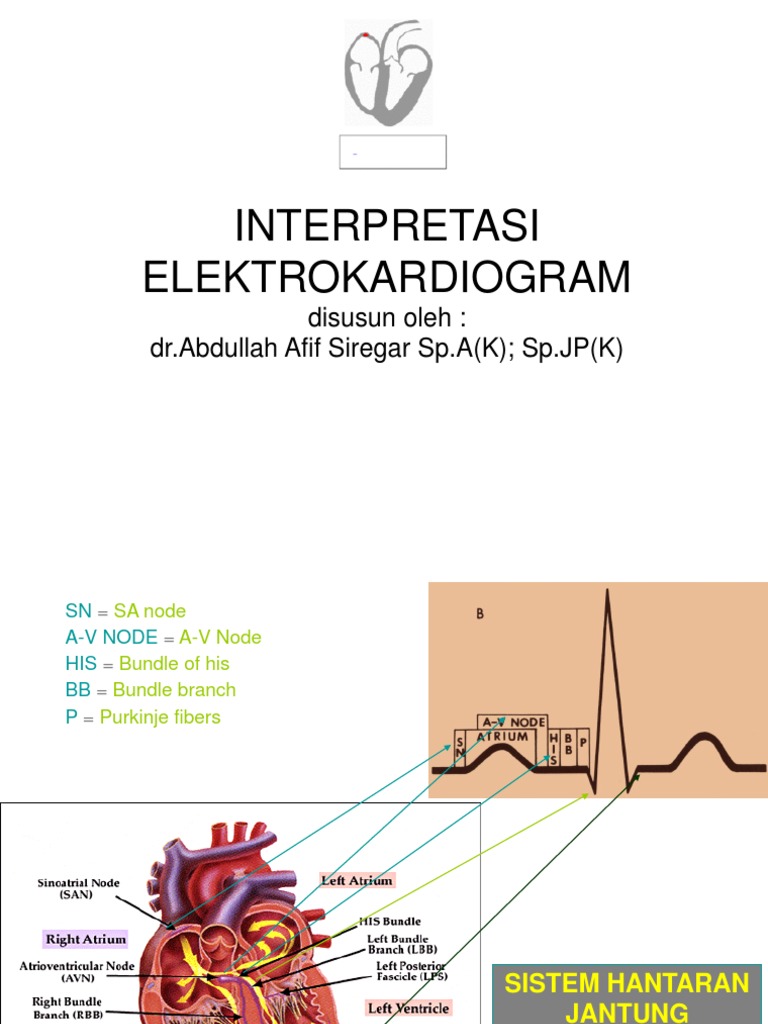 Ecg thesis 2009 image