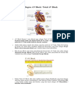 Bahan 3rd Degree AV Block