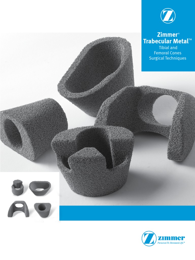Zimmer Trabecular Metal Tibial Cone Surgical Technique PDF Dental