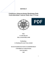 Referat Adenoca Duodenum PDF