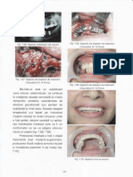 N. Forna - Protetica Dentara Vol II-3