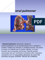 Cancerul Pulmonar